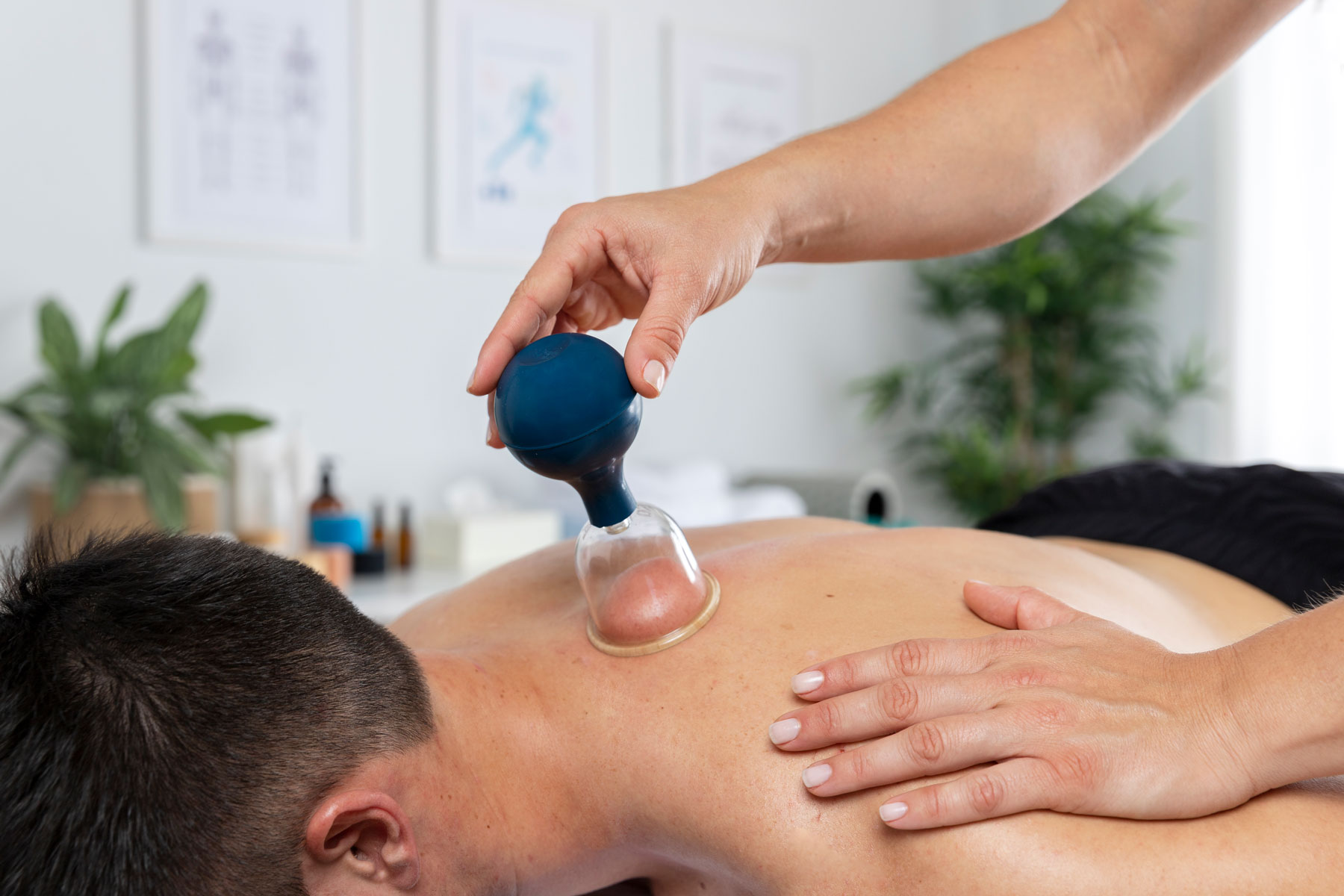 osteo cupping asnieres